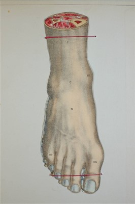 Lot 581 - Witkowski, Gustave Joseph