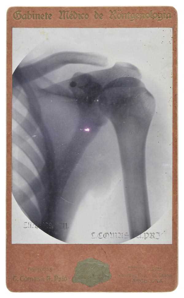 Lot 435 - X-Ray Photographs.