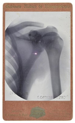 Lot 435 - X-Ray Photographs.