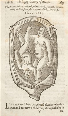 Lot 9 - Guillemeau (Jacques). Child-Birth or, the Happy Deliverie of Women, 1612