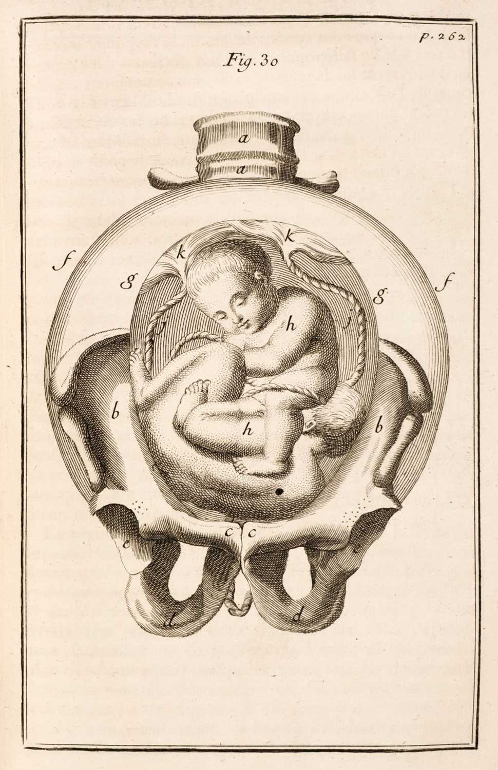 Lot 160 - Deventer (Hendrik van). Observations importantes sur le manuel des accouchemens, 1739/33