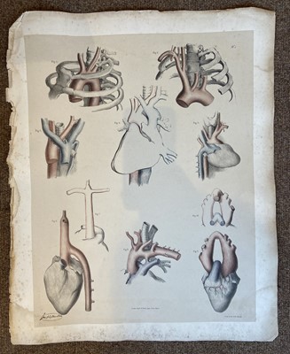 Lot 129 - Maclise (Joseph). Fifty medical and surgical lithographs, circa 1856