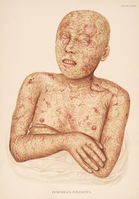 Lot 381 - Crocker (H. Radcliffe). Atlas of the Diseases of the Skin... , 1903