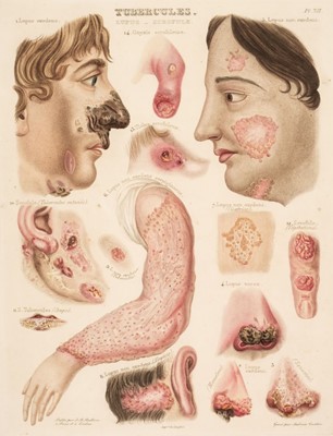 Lot 368 - Rayer (Pierre). A Theoretical and Practical Treatise on the Diseases of the Skin, 2nd edition